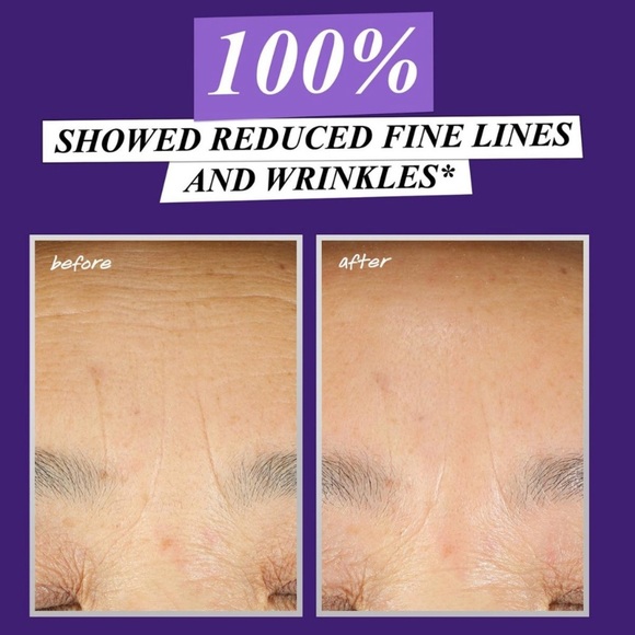 ONLY 1! Kiehl’s Micro-Dose Anti-Aging Retinol Serum Mini💧 NEW - Picture 6 of 11